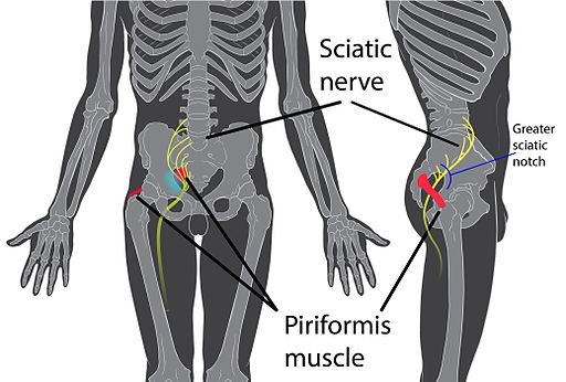 travell and simons trigger point for sciatica